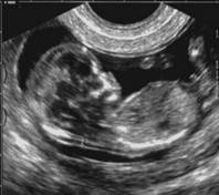 adaptação celular 33-utero puerperal