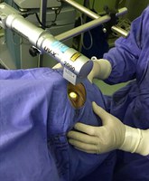 HUGG realiza procedimento avançado no combate ao Ceratocone