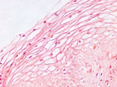 vagina 