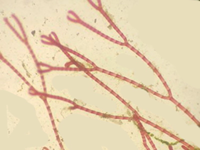 Centroceras