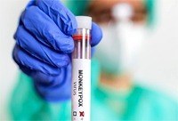 Estudo coordenado pela UNIRIO analisa manifestações neurológicas associadas à monkeypox